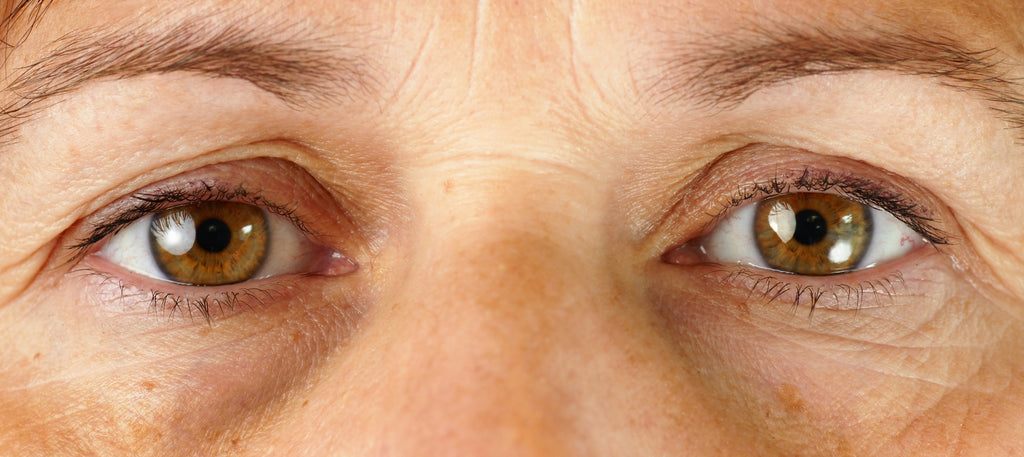 How to treat the 3 most common aging eye problems...